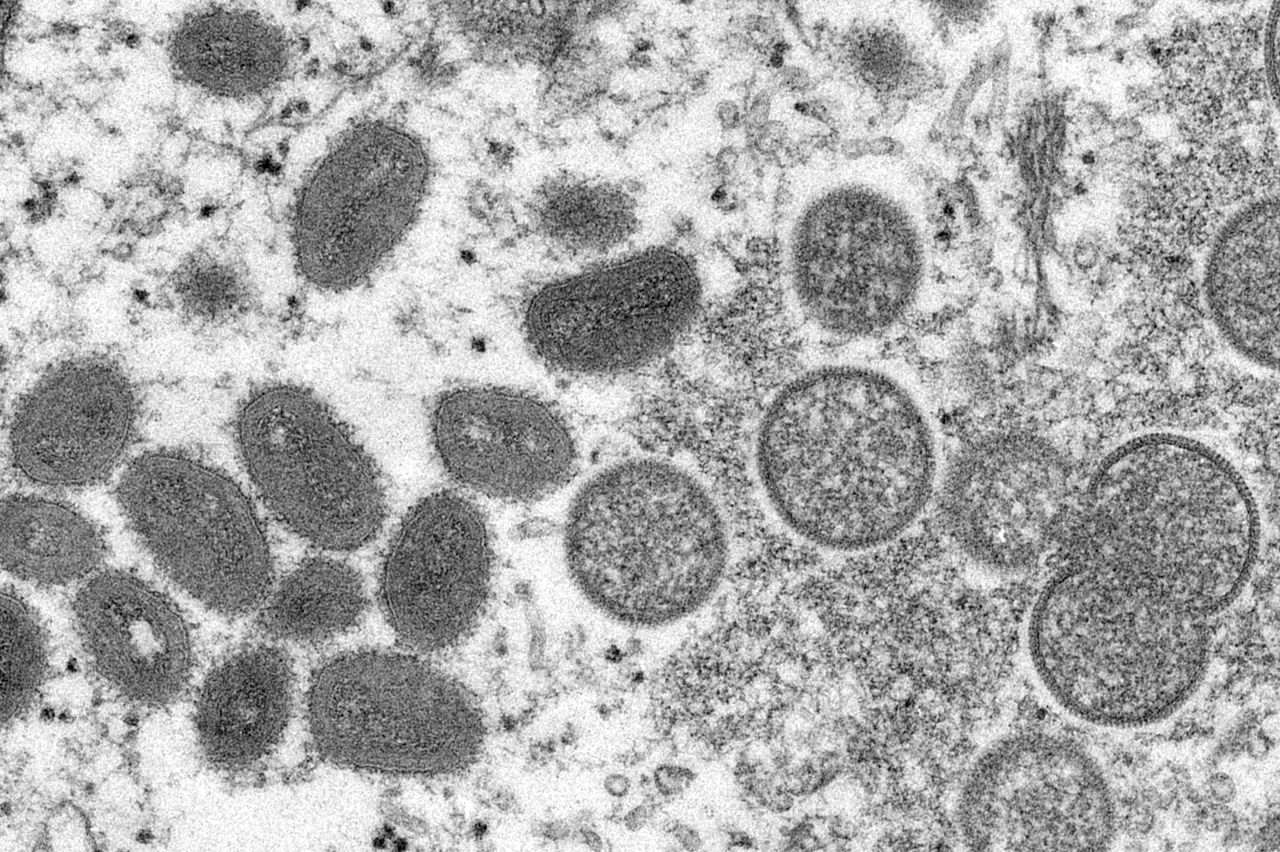 As COVID-19 spread deepens, Arkansas reports a dozen cases of monkeypox