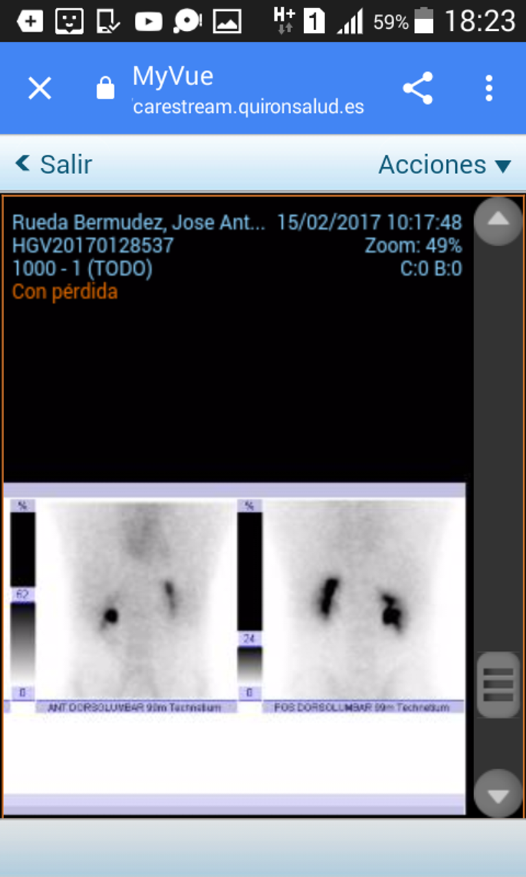 Medical scan showing inflammation located where the spine meets the pelvis, taken nearly two years after Rueda's accident